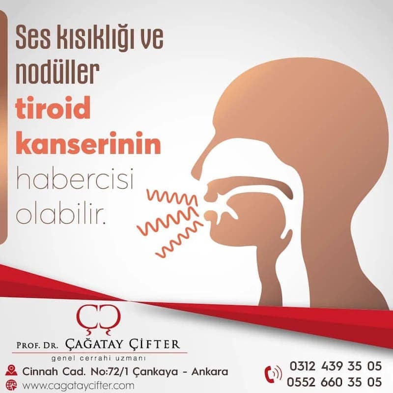 Ses kısıklığı ve tiroid nodülleri tiroid kanseri belirtisi olabilir