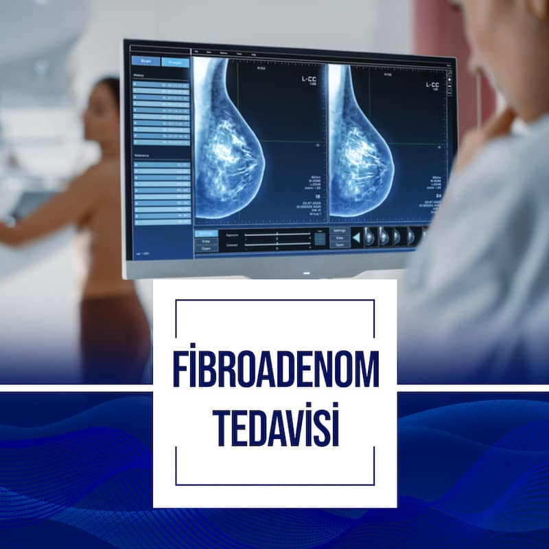 Meme Fibro Adenom Ameliyatı Ankara
