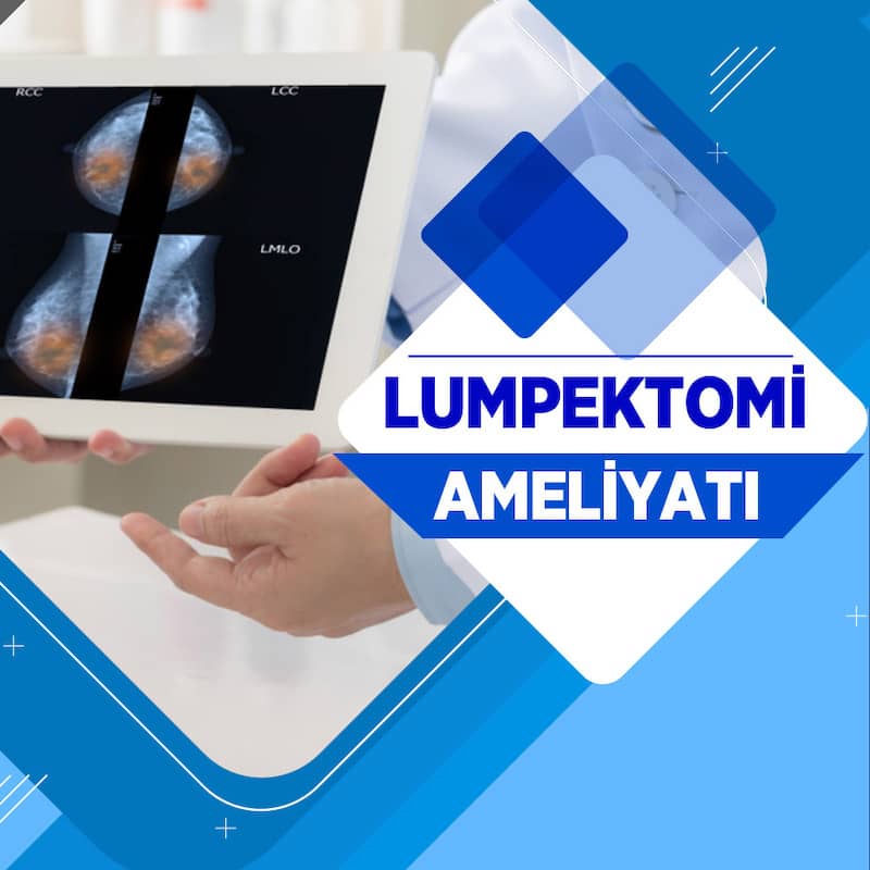 Lumpektomi ameliyatı ankara